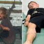 8χρονος δέχθηκε επίθεση από… καρχαρίες και τον έσωσε η 12χρονη αδερφή του!